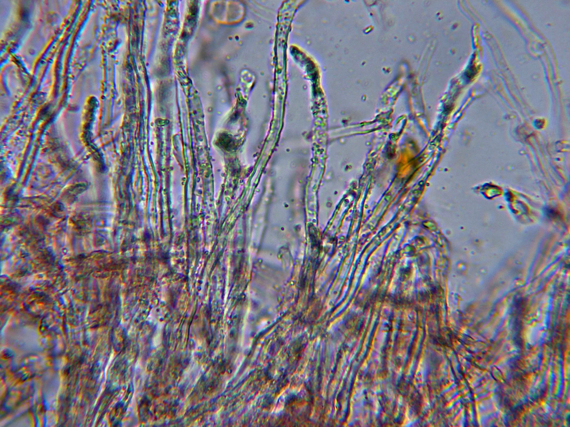 Microscopía de Schizophyllum amplum - 10 - Pelos con incrustaciones-001